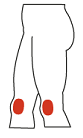 Runner's Knee in Toronto