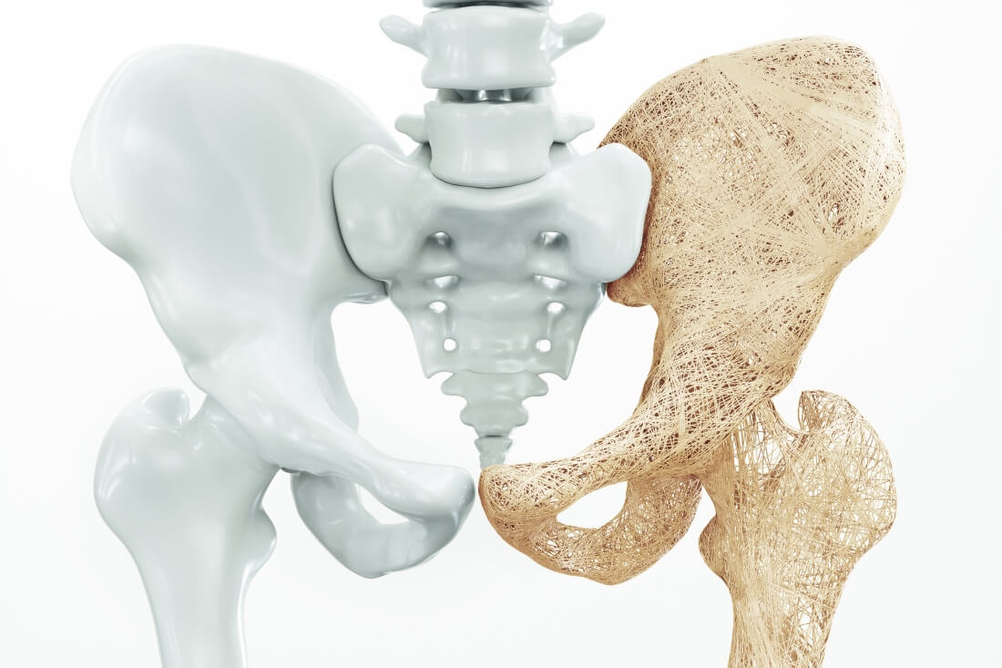 osteoporosis-physiotherapy-treatment-toronto.jpg
