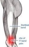 site of IT band pain
