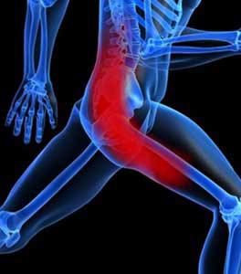 Piriformis Syndrome 2