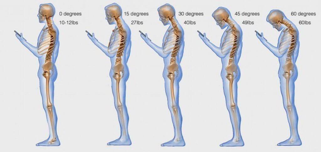 texting neck images | Rebalance Sports Medicine texting neck images