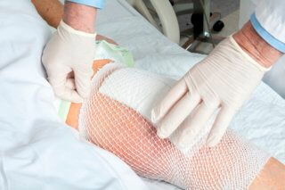 knee replacement surgery toronto