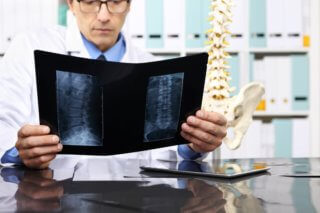 failed back surgery syndrome - chiropractic toronto