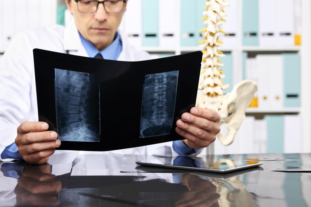 failed-back-surgery-syndrome-chiropractic-toronto.jpg