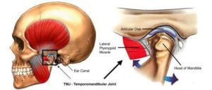 tmj (temporomandibular joint)