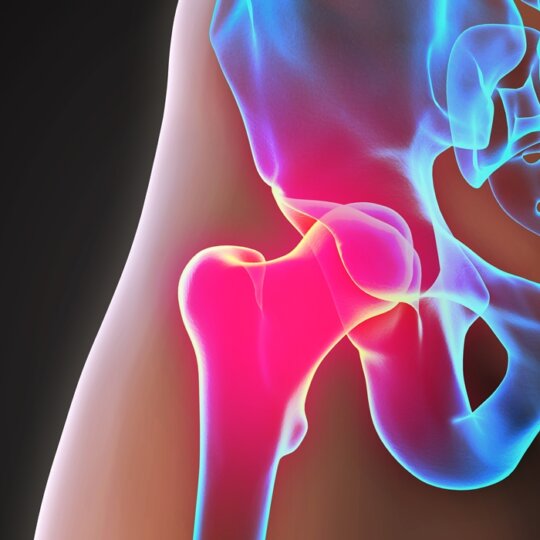 Hip Labral Tears: Causes, Symptoms, Treatment and Exercises