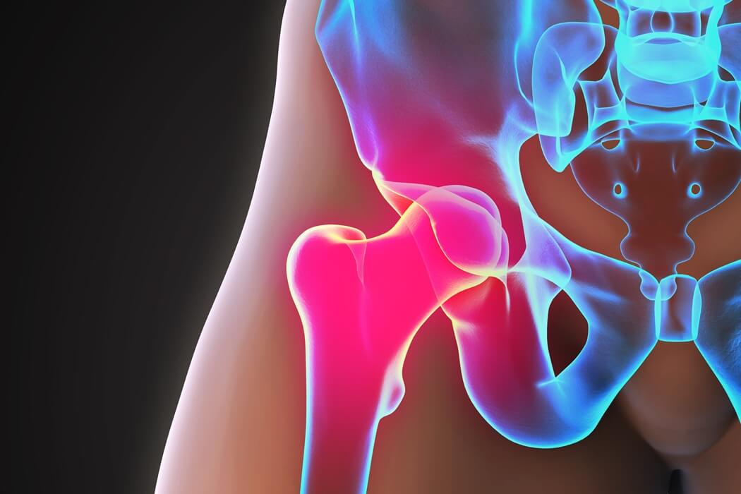 How a Hip Massage Provides Ongoing Hip Pain Relief