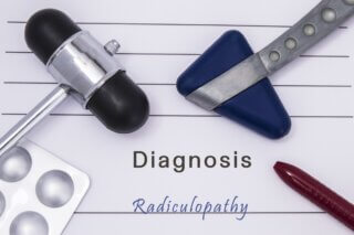 Radiculopathy or Pinched Nerves - Physiotherapy Chiropractic and Massage Treatment in Toronto