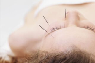 cosmetic acupuncture downtown toronto feature