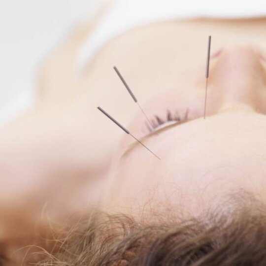 Discover the Anti-Aging Power of our Deluxe Cosmetic Acupuncture Treatment