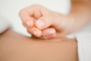 Traditional Chinese Medicine TCM Acupuncture treatment in downtown Toronto