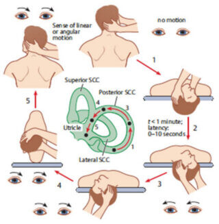 epleys-particle-repositioning-procedure | Rebalance Sports Medicine Epley’s Particle Repositioning Procedure