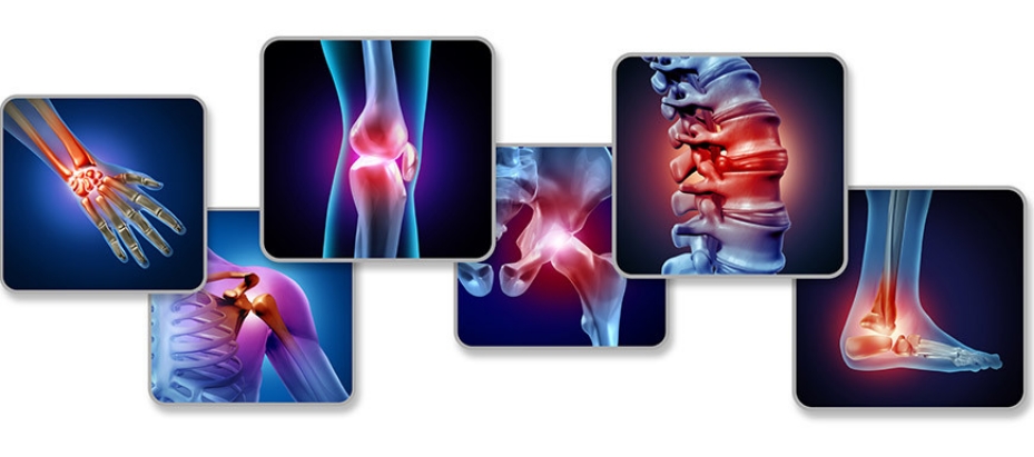 rheumatoid-arthritis.jpg