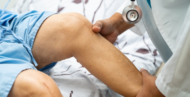 patient-show-her-scars-surgical-total-knee-joint-replacement.jpg